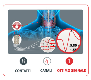 ALM chirurgia della tiroide